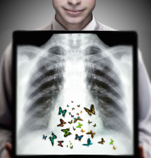  Butterflies in your stomach gallery