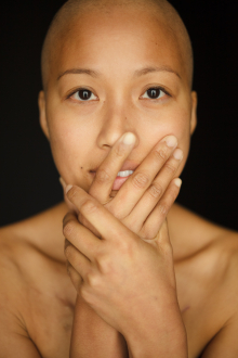 Title: Facing Chemo gallery